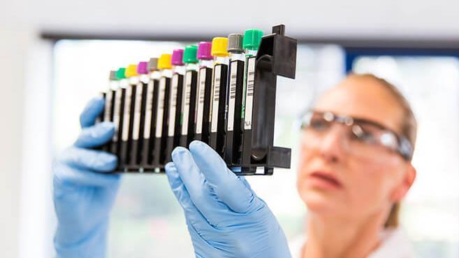 Azioni Diasorin: ok FDA a test Flex assist per nuovo recupero in Borsa