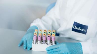 Diasorin: da FDA ok a nuovi test Covid, cosa fare in Borsa?